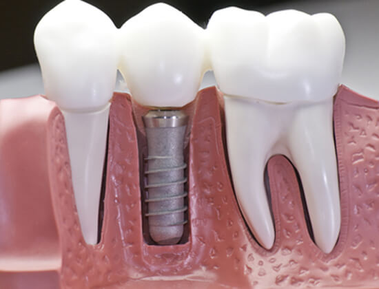 Best Dentist in Gurgaon
