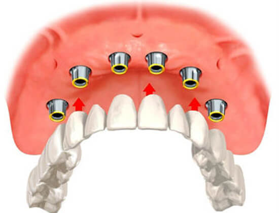 Dentists Sohna Road Gurgaon