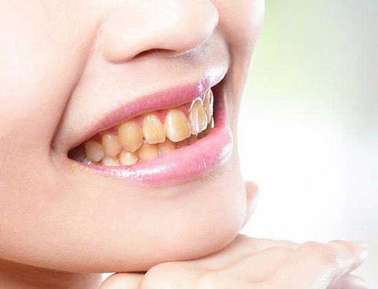 Dental Clinic Gurgaon