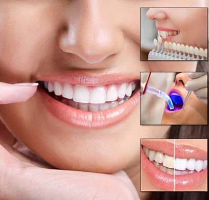 Dental Cosmetic Treatment Sohan Road Gurgaon