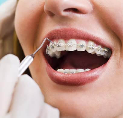 Best Orthodontics Doctor Sohan Road Gurgaon