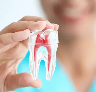 Best Root Canal Doctor Sohan Road Gurgaon